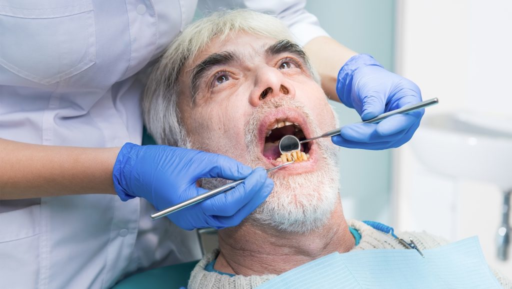 Oral Cancer Screening Chapel Hill Periodontics & Implants